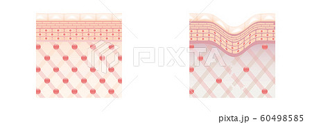 肌図　断面図　比較 60498585