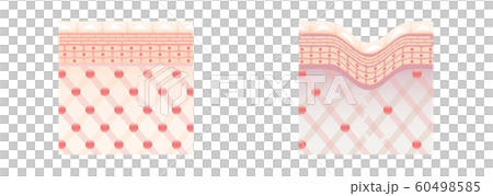 皮膚視圖橫截面比較 60498585