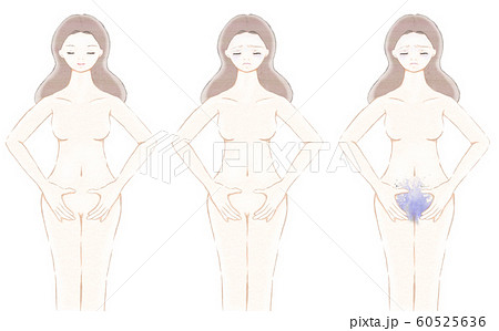 女性の体-パターン別-不調 60525636
