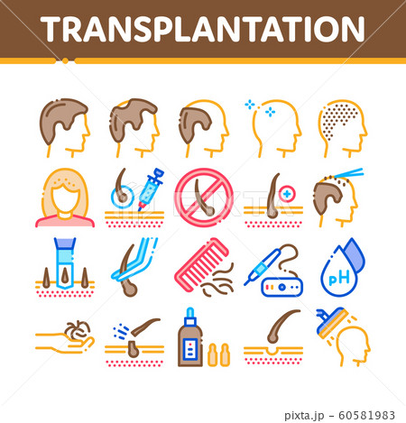 Hair Transplantation Collection Icons Set Vector Hair Transplantation Collection Icons Set Vector 60581983