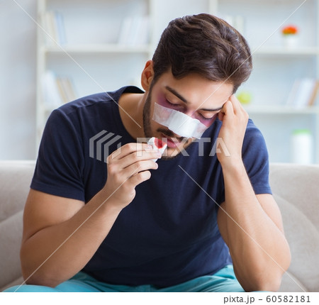 Young man recovering healing at home after plastic surgery nose 60582181