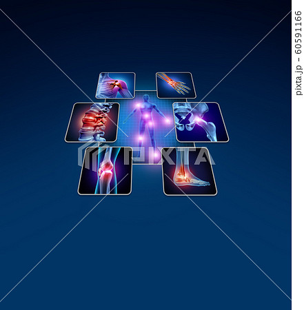 Joint Pain Diagram Joint Pain Diagram 60591166