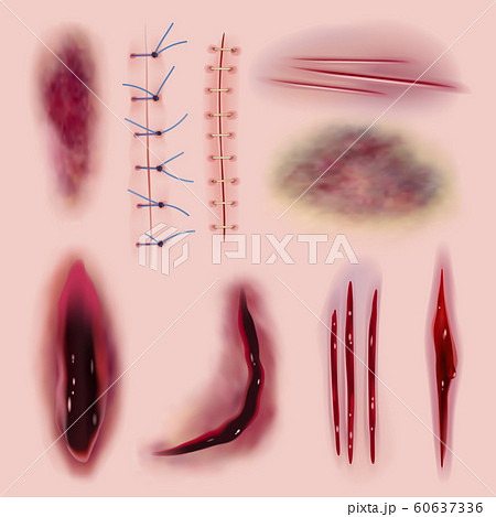Stitching realistic. Coloring bloody scars cuts different wounds medicine or horror collection Stitching realistic. Coloring bloody scars cuts different wounds medicine or horror collection 60637336