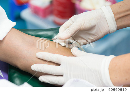 Nurse receiving blood from blood donor in hospital 60640619