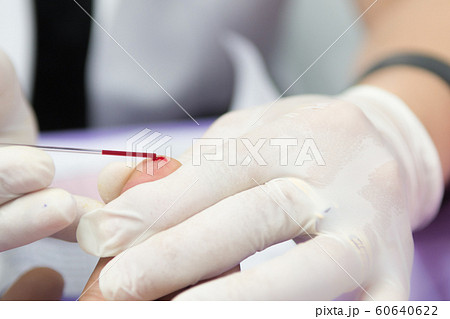Nurse receiving blood from blood donor in hospital 60640622