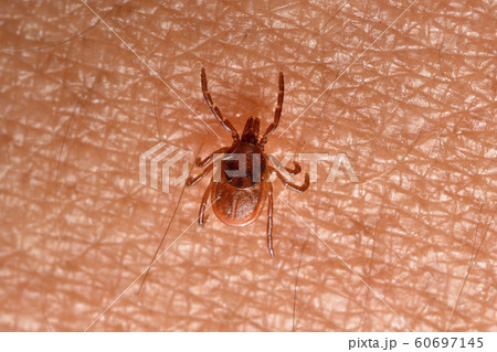 肌の上を歩くマダニ 60697145