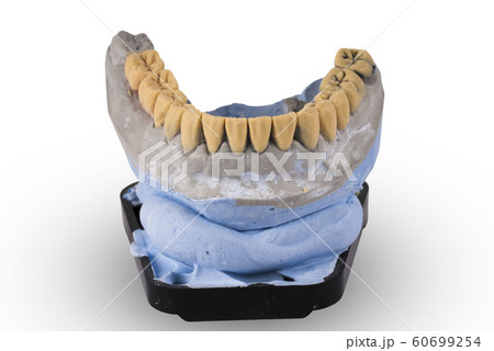 Gypsum model of human jaw isolated on white Gypsum model of human jaw isolated on white 60699254