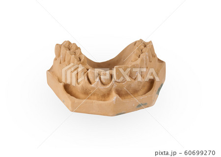 Gypsum model of human jaw Gypsum model of human jaw 60699270