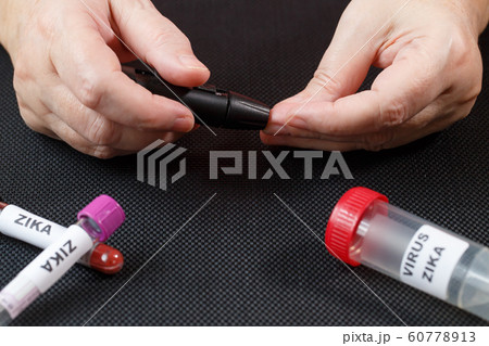 Zika virus concept footage with test tube on black Zika virus concept footage with test tube on black 60778913