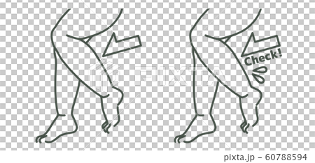 Thick legs-calf-check Thick legs-calf-check 60788594