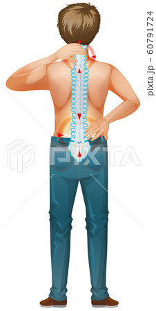 Back of man and his back pain 60791724