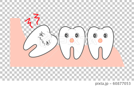 歯並び 親知らず図説 断面図のイラスト素材