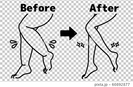 Thick and thin legs-calf-before and after-black Thick and thin legs-calf-before and after-black 60892877