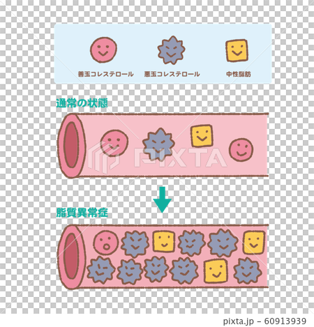 コレステロール　中性脂肪　善玉　悪玉　動脈硬化　イラスト 60913939