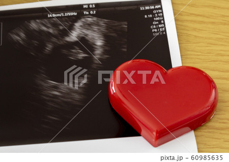 赤ちゃんの超音波写真とハート 赤ちゃんの超音波写真とハート 60985635