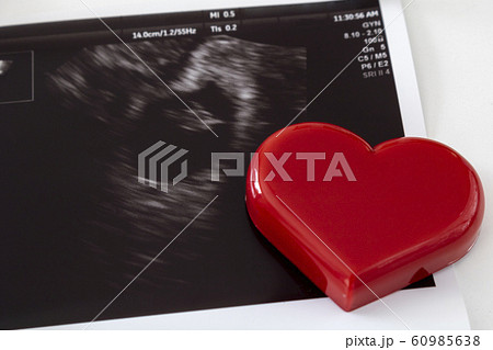 赤ちゃんの超音波写真とハート 60985638