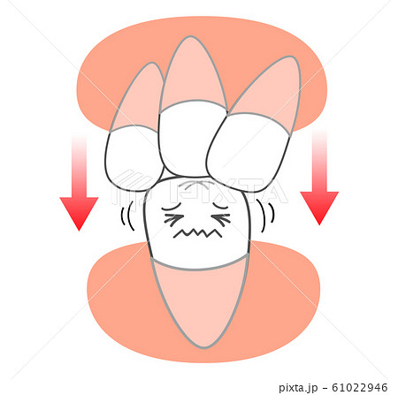 歯並び偏り圧力図説 矯正キャラクター 歯並び偏り圧力図説 矯正キャラクター 61022946