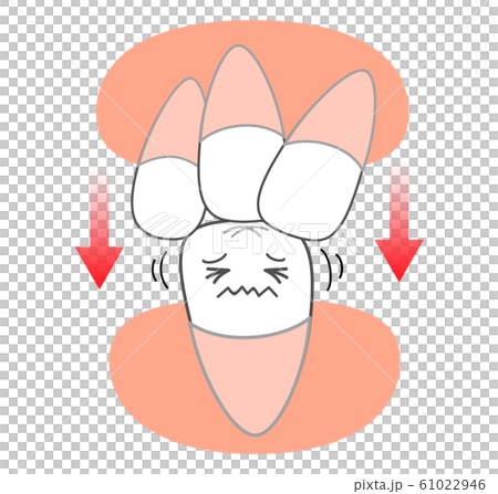 歯並び偏り圧力図説 矯正キャラクター 歯並び偏り圧力図説 矯正キャラクター 61022946