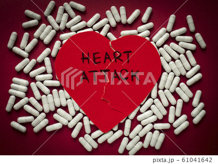 Heart attack concept.  61041642