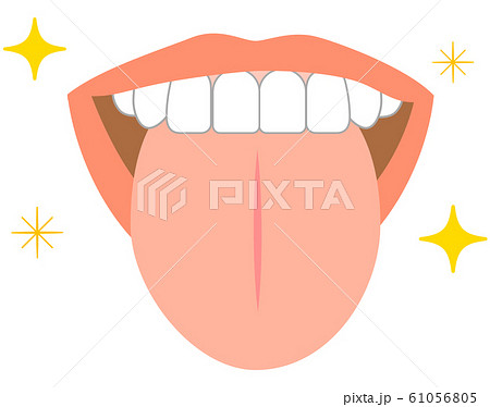 健康なキラキラ舌 舌のトラブル症状のイラスト素材