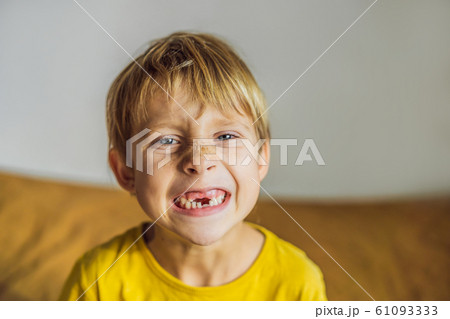Litle caucasian boy shows that he lost his teeth 61093333