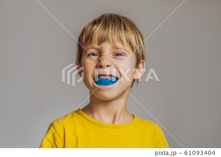 Six-year old boy shows myofunctional trainer. Helps equalize the growing teeth and correct bite Six-year old boy shows myofunctional trainer. Helps equalize the growing teeth and correct bite 61093404