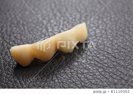入れ歯，仮歯 61110302