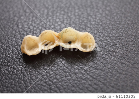 入れ歯，仮歯 61110305