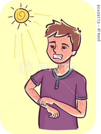 Man Photosensitivity Illustration 61160438