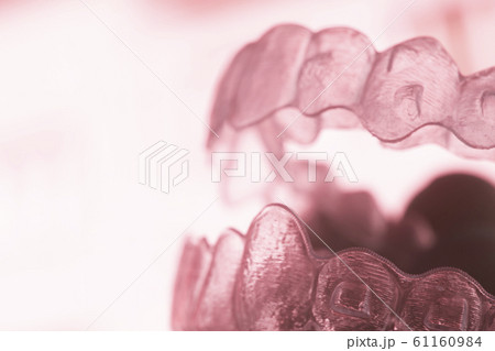 Invisible bracket teeth aligners 61160984