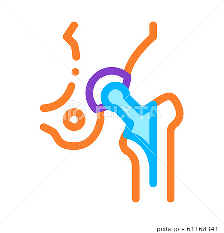 Hip Implant Replacement Biomaterial Vector Icon 61168341