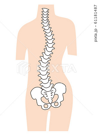 歪んだ背骨 脊椎側弯症のイラスト素材