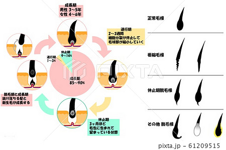 ヘアサイクル 毛髪サイクル ヘアサイクル 毛髪サイクル 61209515