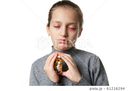 Allergic reaction, skin rash, close view portrait Allergic reaction, skin rash, close view portrait 61216294