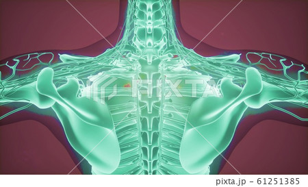 3D magnetic resonance image scan 3D magnetic resonance image scan 61251385