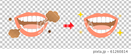 口臭エチケットビフォーアフター 61260814