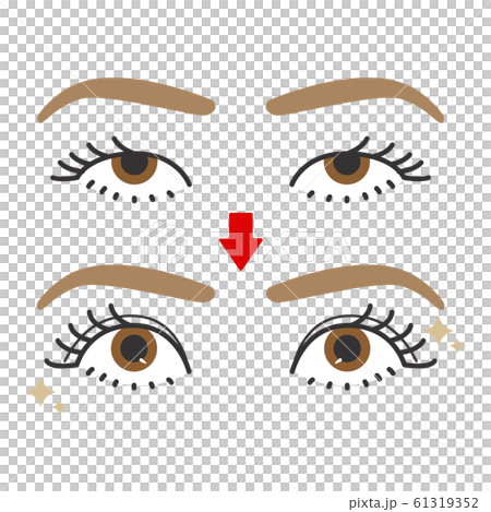 目　一重　二重　ビフォーアフター 61319352