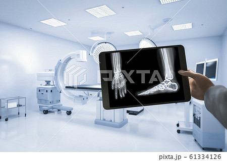 X-ray film diagnosis X-ray film diagnosis 61334126