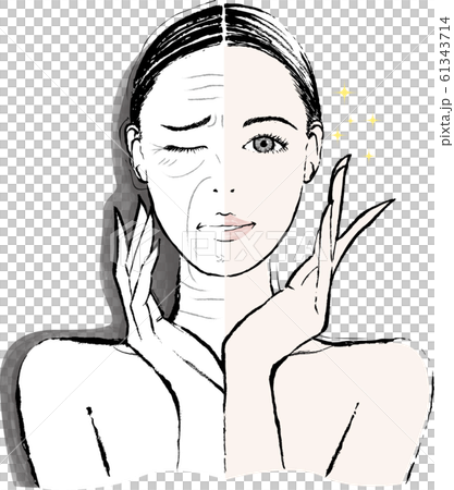 Woman wrinkle before after Woman wrinkle before after 61343714