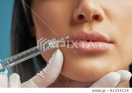Cosmetic hyaluronic injection in lips. 61354124