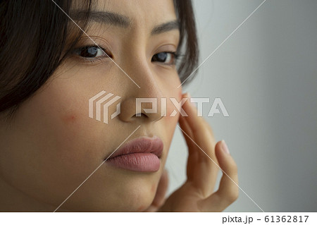 肌荒れに悩む女性 61362817