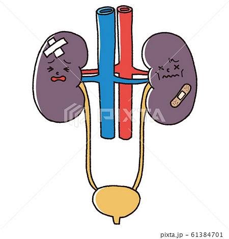 不健康な腎臓 61384701