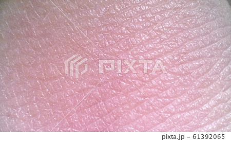 肌測定イメージ 肌測定イメージ 61392065