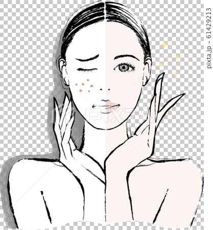 女性　頰の肌荒れ　ビフォーアフター 61429213