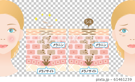 ターンオーバー　肌の断面図と女性 61461239