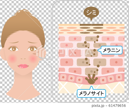 污點女人的皮膚結構 61479656