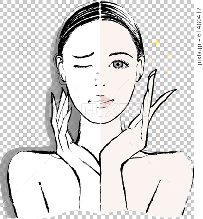 女性　鼻のニキビ　ビフォーアフター 61480412