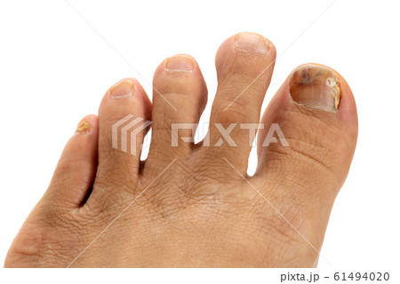 爪水虫 爪水虫 61494020
