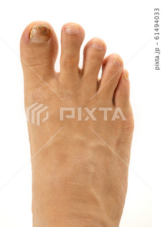 爪水虫 爪水虫 61494033