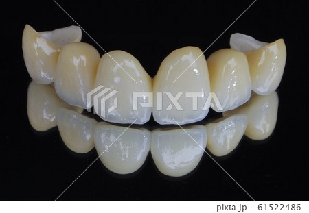 きれいな歯 61522486